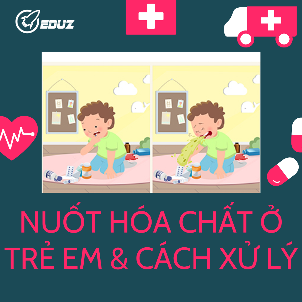 Trường Hợp Trẻ Nuốt Hóa Chất Và Cách Xử Lý